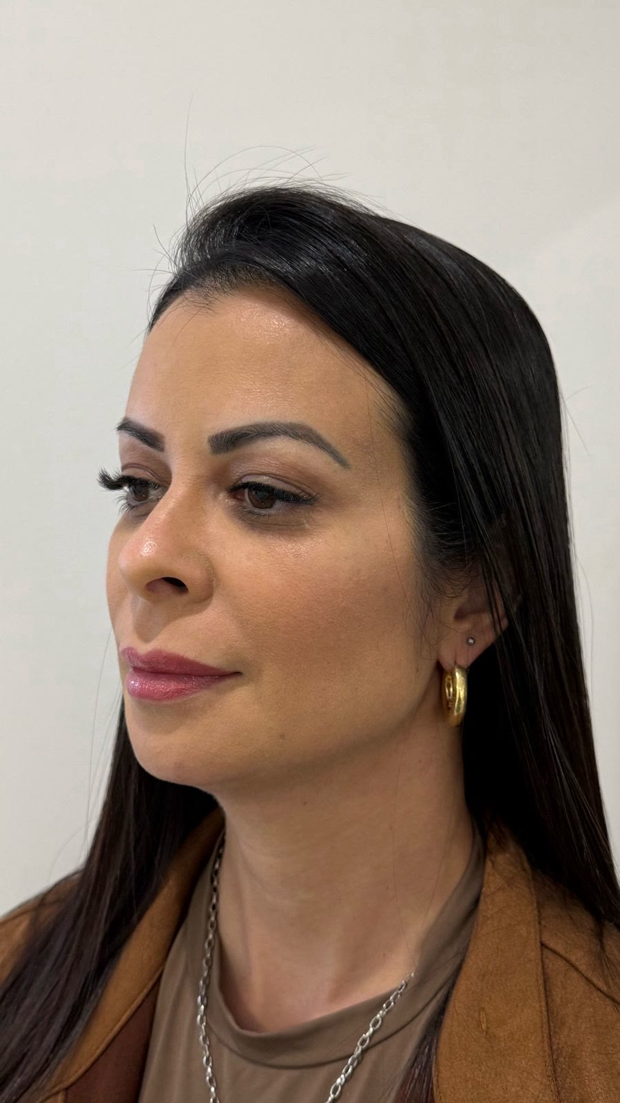 Paciente da clínica após reestruturação facial